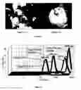 Fig. 11 - NANOPARTICULATE TELMISARTAN COMPOSITIONS AND PROCESS FOR THE PREPARATION THEREOF