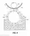 Fig. 12 - Hemispherical coating method for micro-elements