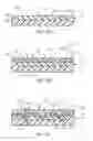 Fig. 04 - Article Having a Selectively Texturable Surface and Method of Using
