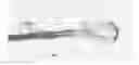 Fig. 05 - EASY ORTHODONTIC SLIDER