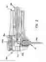 Fig. 03 - Modified-ouput fiber optic tips