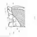 Fig. 03 - Emergence Profile Guide for a Dental Bur