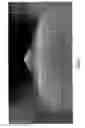Fig. 08 - Apparatus for the detection and analysis of particles in fluids