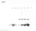 Fig. 07 - Rhamnose promoter expression system