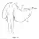 Fig. 46 - Sensors for detecting substances indicative of stroke, ischemia, infection or inflammation