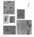 Fig. 07 - METHODS AND MATERIALS FOR DIAGNOSING LIGHT CHAIN AMYLOIDOSIS