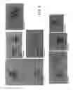Fig. 09 - METHODS AND MATERIALS FOR DIAGNOSING LIGHT CHAIN AMYLOIDOSIS