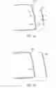 Fig. 09 - Golf club head having a multi-material face