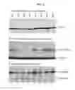 Fig. 06 - Method and Composition for Cancer Diagnosis and Treatment