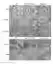 Fig. 01 - METHODS FOR DIAGNOSING CHRONIC KIDNEY DISEASE AND ASSESSING THE RISK OF DISEASE PROGRESSION
