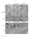 Fig. 05 - METHODS FOR DIAGNOSING CHRONIC KIDNEY DISEASE AND ASSESSING THE RISK OF DISEASE PROGRESSION