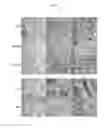 Fig. 06 - METHODS FOR DIAGNOSING CHRONIC KIDNEY DISEASE AND ASSESSING THE RISK OF DISEASE PROGRESSION