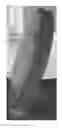 Fig. 01 - Compositions and methods for controlling fluid loss