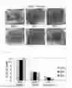 Fig. 08 - Anti-Gram Negative Bacteria Agent