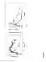 Fig. 07 - Method for controllably releasing a drug conjugate within subcutaneous tissue in response to the local concentration of an indicator