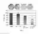 Fig. 11 - Methods of correcting imbalance between bone resorption and bone formation and kits and compositions therefor