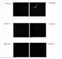 Fig. 19 - Methods of correcting imbalance between bone resorption and bone formation and kits and compositions therefor