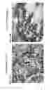 Fig. 31 - Methods of correcting imbalance between bone resorption and bone formation and kits and compositions therefor
