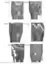 Fig. 32 - Methods of correcting imbalance between bone resorption and bone formation and kits and compositions therefor