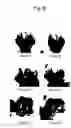 Fig. 05 - Combined preparation for treating joint diseases