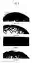Fig. 06 - Combined preparation for treating joint diseases