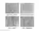 Fig. 01 - Methods and compositions for treating degenerative and ischemic disorders