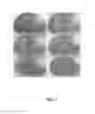 Fig. 02 - Neuroprotective compositions and methods