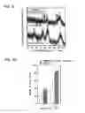 Fig. 06 - Fiber wadding for filling bone defects