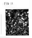 Fig. 07 - Fiber wadding for filling bone defects