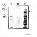 Fig. 02 - Integrin Heterodimer And A Subunit Thereof