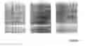Fig. 10 - Integrin Heterodimer And A Subunit Thereof