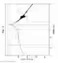 Fig. 09 - HEARING PROSTHESIS HAVING A FLEXIBLE ELONGATE ENERGY TRANSFER MECHANISM
