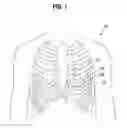 Fig. 02 - Surgical stabilizer and closure system