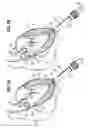 Fig. 06 - Surgical stabilizer and closure system