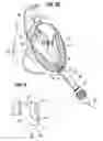 Fig. 07 - Surgical stabilizer and closure system