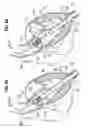 Fig. 09 - Surgical stabilizer and closure system