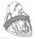 Fig. 01 - Method and apparatus for external stabilization of the heart