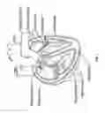Fig. 02 - Method and apparatus for external stabilization of the heart