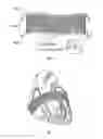 Fig. 06 - Method and apparatus for external stabilization of the heart
