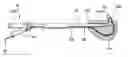 Fig. 01 - Endoscopic methods and devices for transnasal procedures