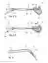 Fig. 06 - Endoscopic methods and devices for transnasal procedures