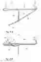Fig. 09 - Endoscopic methods and devices for transnasal procedures