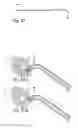 Fig. 10 - Endoscopic methods and devices for transnasal procedures