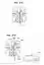 Fig. 19 - Endoscopic methods and devices for transnasal procedures