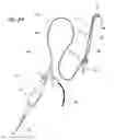 Fig. 22 - Endoscopic methods and devices for transnasal procedures
