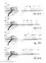 Fig. 27 - Endoscopic methods and devices for transnasal procedures