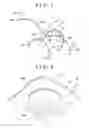 Fig. 02 - Biosignal detecting electrode and biosignal detecting device equipped therewith