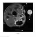 Fig. 09 - Multi-modality nanoparticles having optically responsive shape