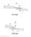 Fig. 10 - Physiological sensor delivery device and method