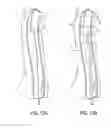 Fig. 16 - Methods of Transvascular Retrograde Access Placement and Devices for Facilitating the Placement